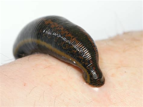 Legacies of the Curse of Leeches: A Haunting Heritage